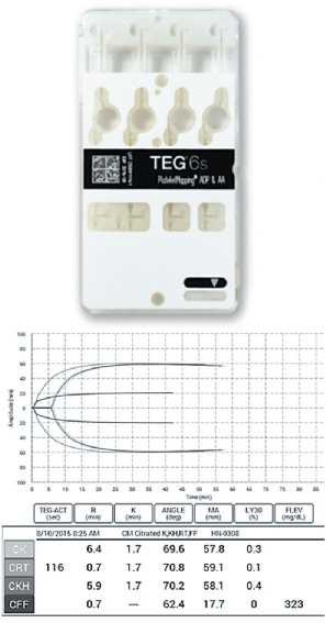 Показатели, полученные TEG6s Показатели, полученные TEG6s