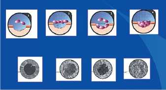 Схема и электронная микроскопия изменений мембраны картриджа при исследовании